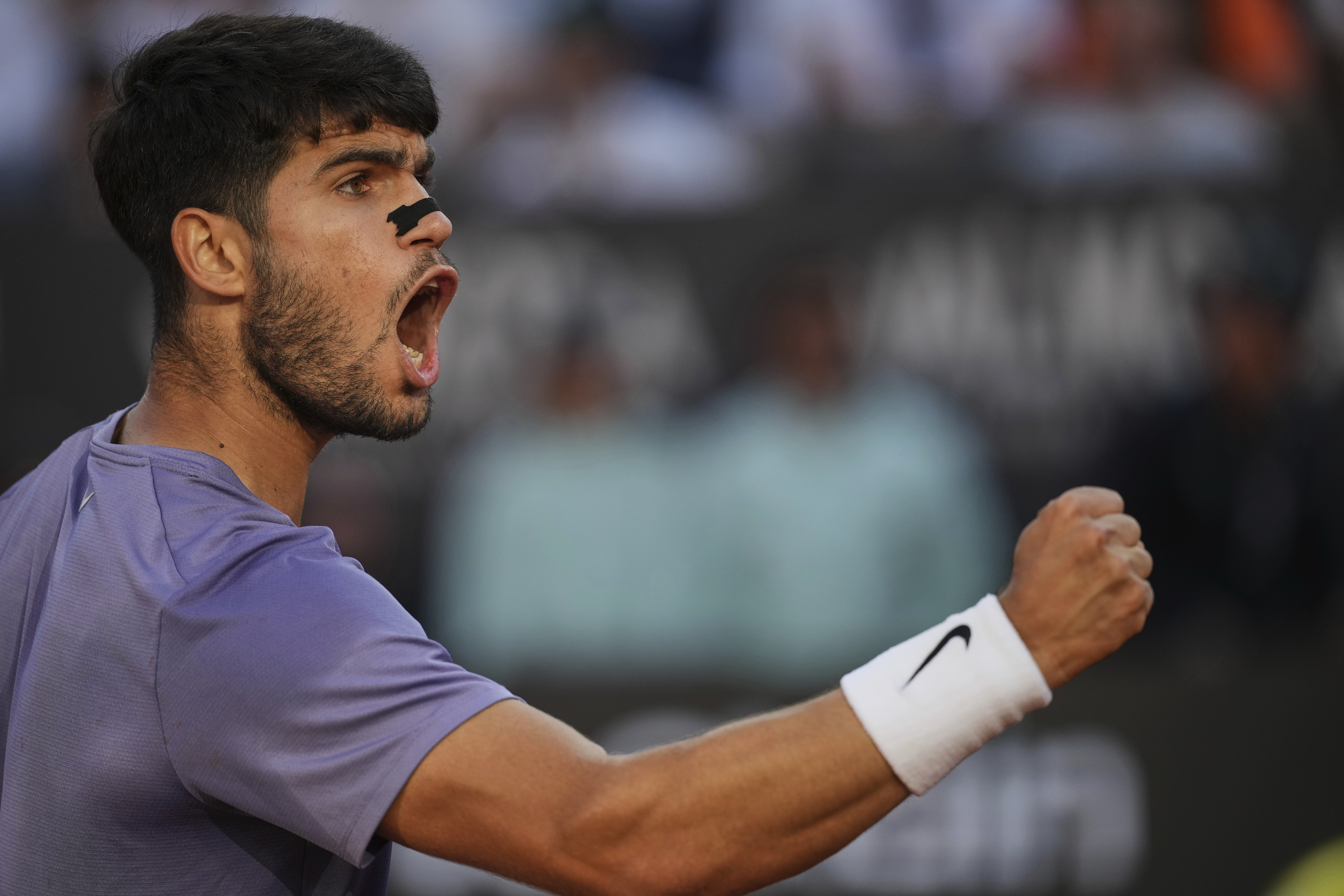 FILE - Spain's Carlos Alcaraz, wearing a nasal strip, reacts after scoring a point against Italy's Jannik Sinner in the final of the Italian Open tennis tournament at the Foro Italico in Rome, May 18, 2025.