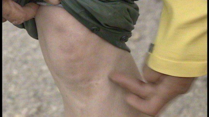 Flagger Hit Twice in One Week