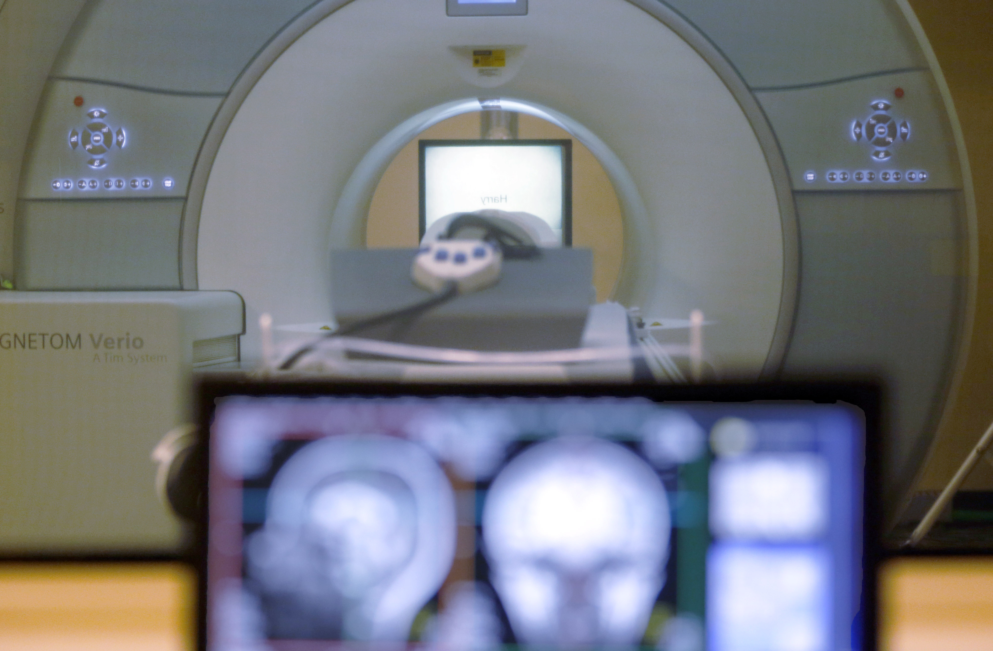 Man dies after heavy weight-training chain around neck pulls him into MRI machine