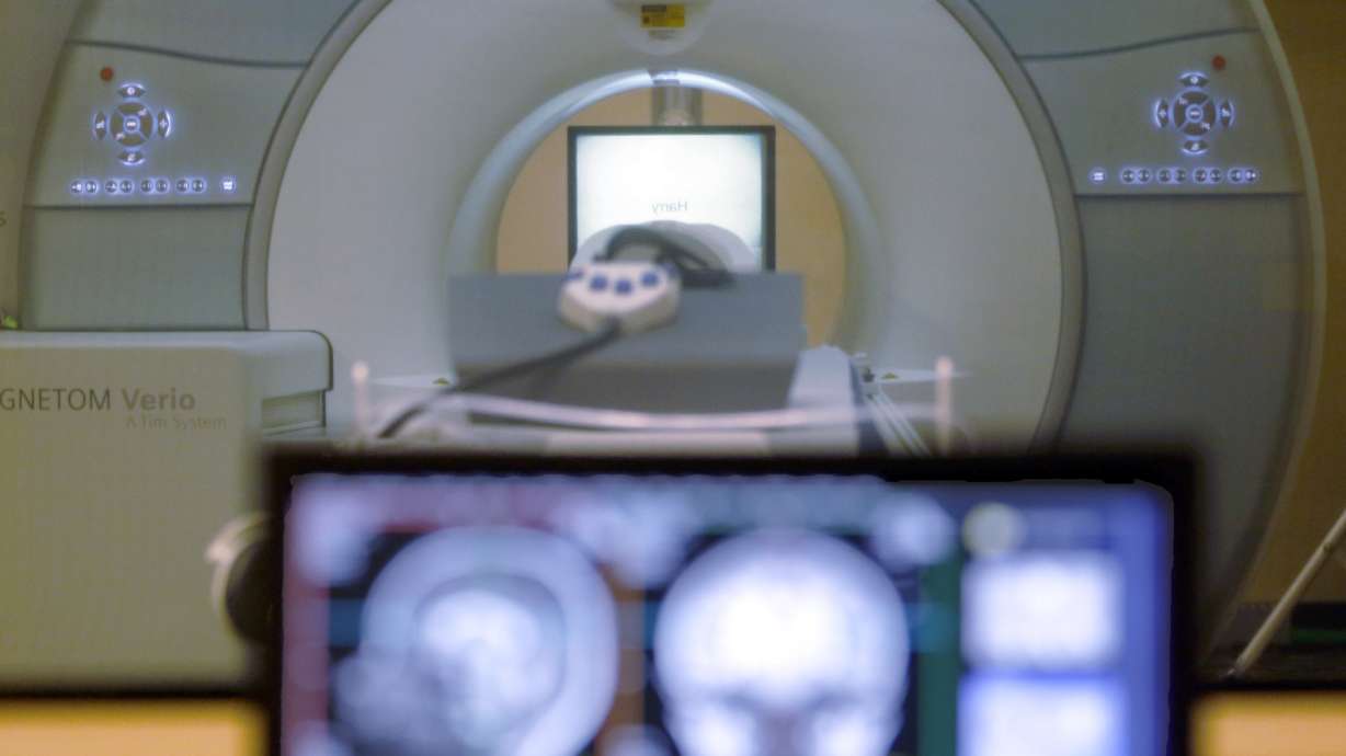 A brain-scanning MRI machine is seen in Pittsburgh, Nov. 26, 2014. A man died after he was pulled into an MRI machine in New York after he walked into the room wearing a large chain necklace, police said.