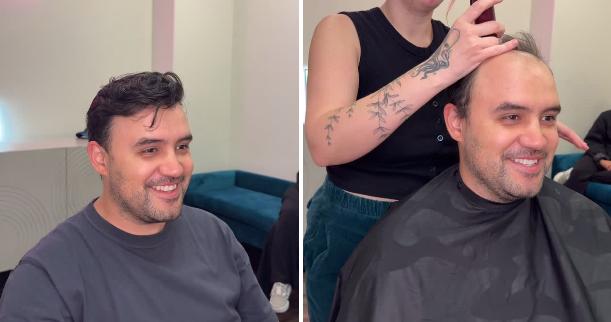 Photos posted by Emily Cheney, the self-proclaimed "Toupee Queen," show before and after placement of a toupee on a client.