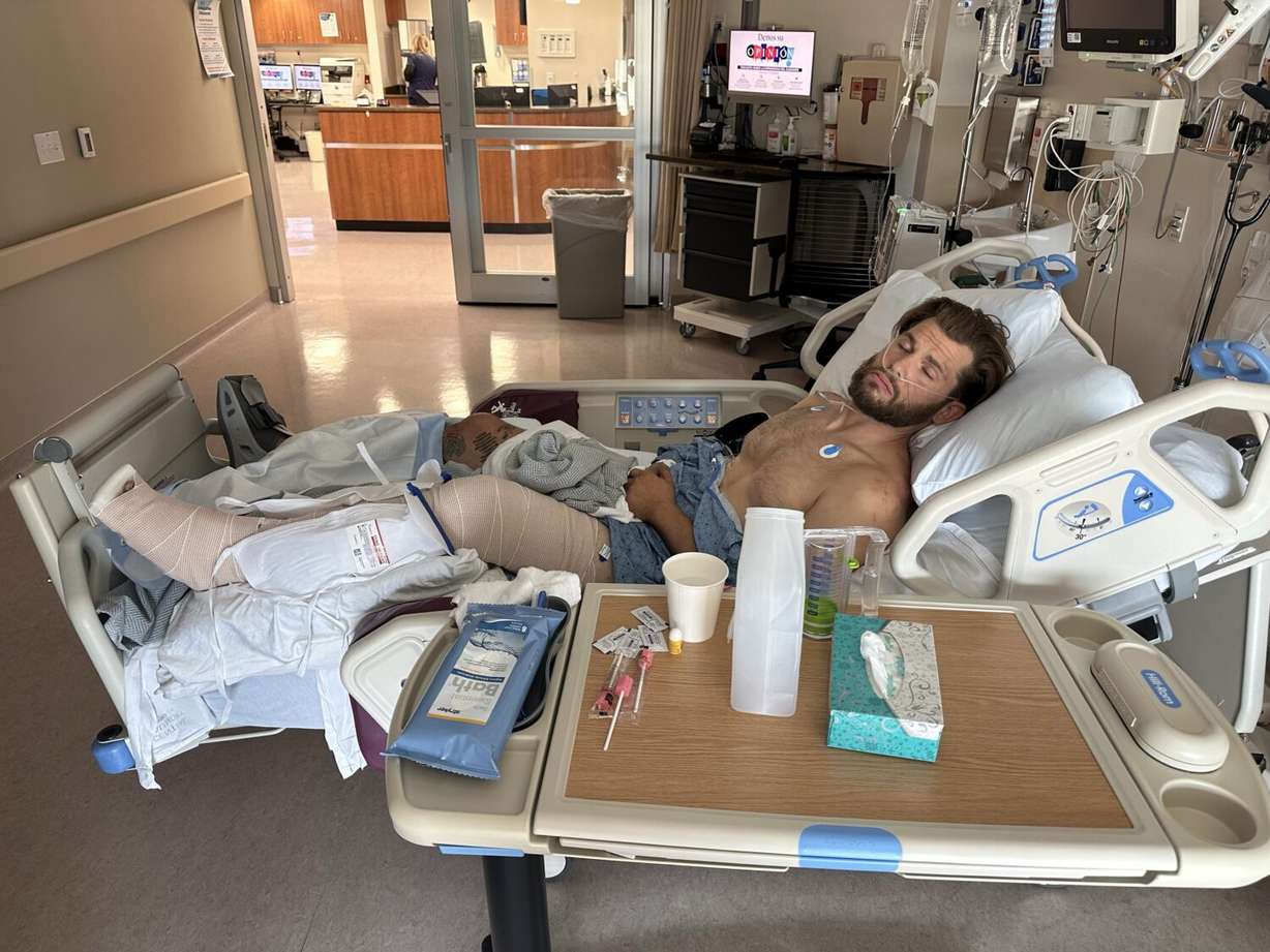 Jake Schmitt recovers from serious injuries in this undated photo. He told KSL he crawled and dragged himself for 11 hours across brush in the Uinta Mountains on July 20 after a rollover in his side-by-side left him badly injured.