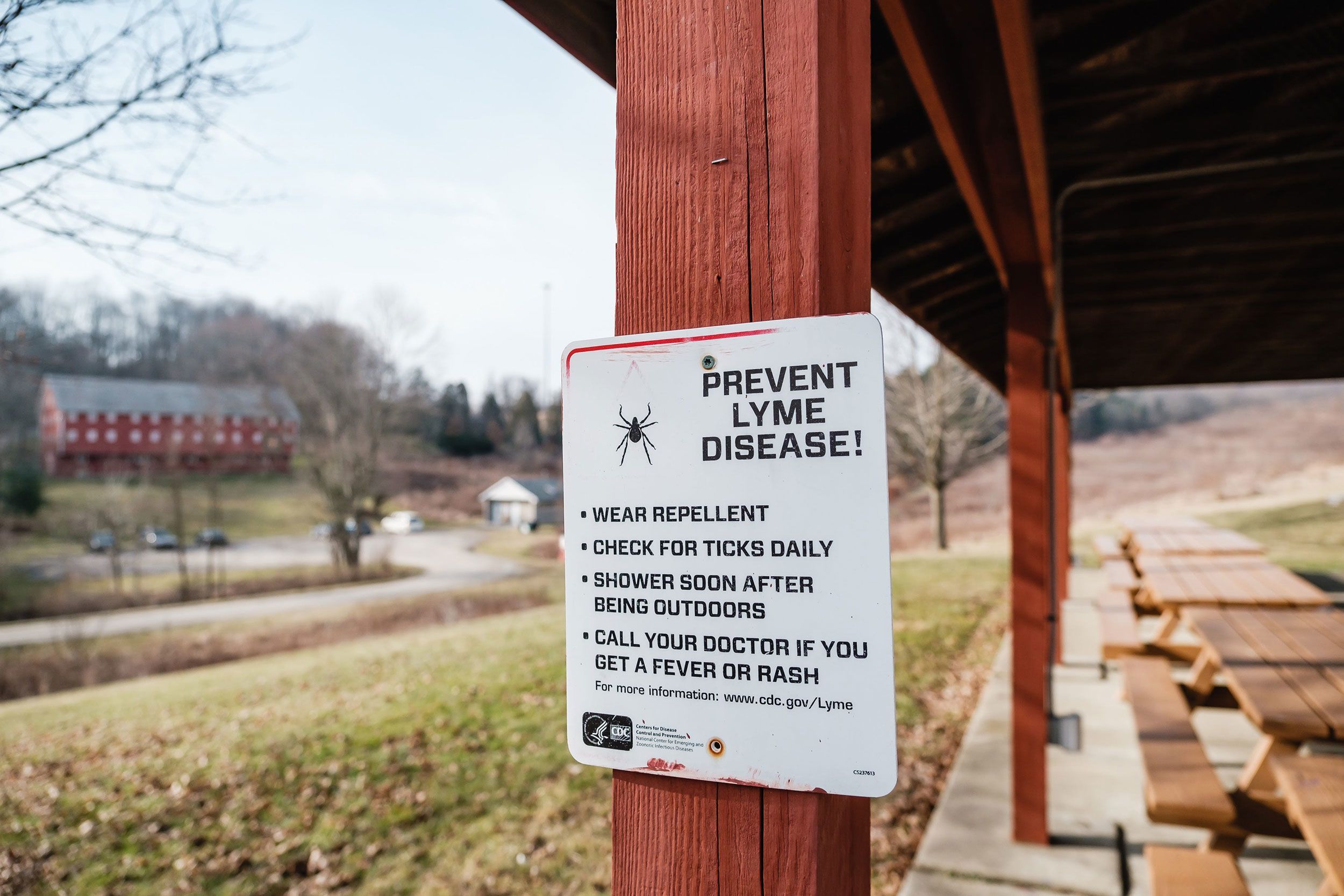A sign warning people about Lyme disease at the Norma Johnson Center. Cases of Lyme disease are continuing to rise, and more people are seeking emergency care for tick bites.