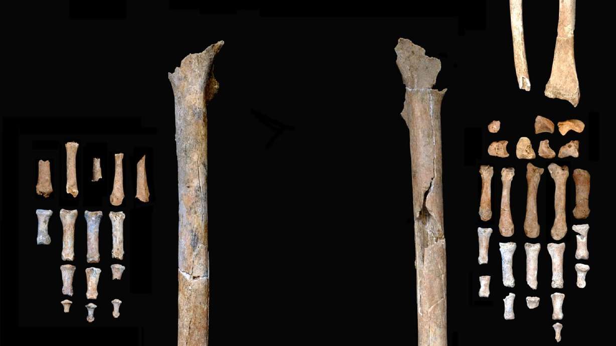 The remains of a man from the Thung Binh 1 cave in Vietnam. A new study shows the man's injuries could be the first evidence of known conflict between hunter-gatherers from the Pleistocene period.