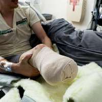 'Am I gonna lose my leg?': St. George motorcyclist recounts life-changing crash