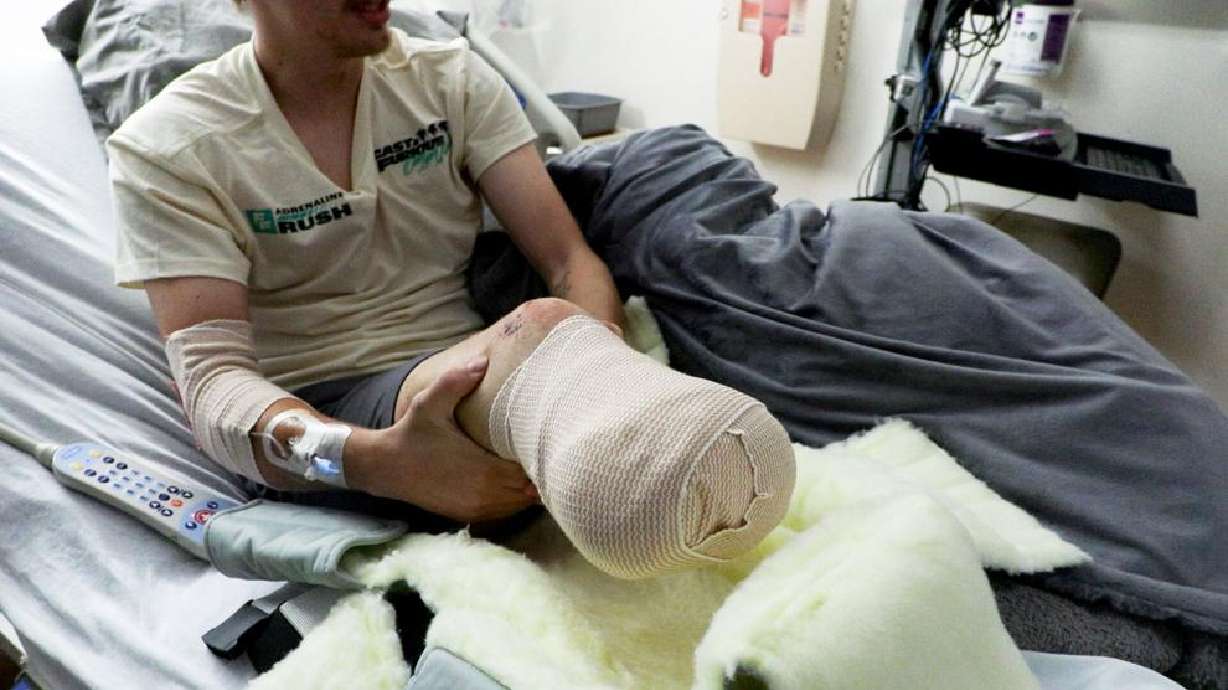 Andrew Rathnow, who lost his lower leg in a motorcycle crash, is photographed during an interview at St. George Regional Hospital, Tuesday.