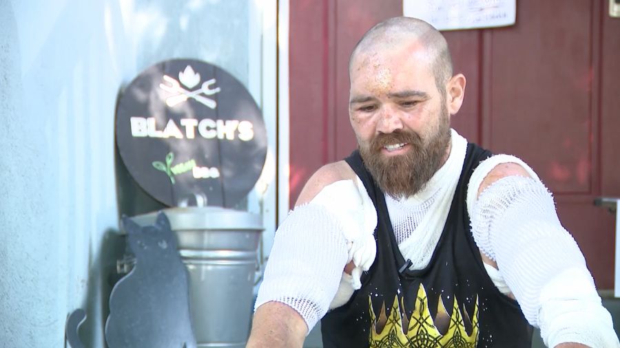 Chef crawled through flames to survive fire, but restaurant destroyed