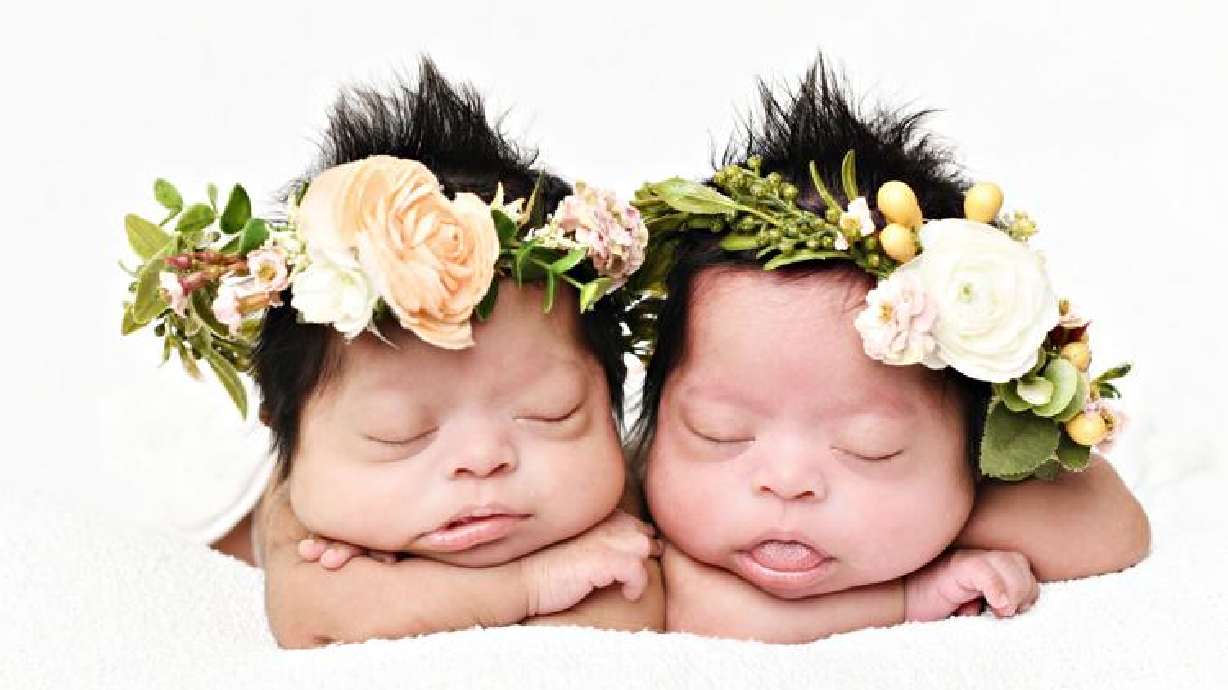 Identical twins Violeta and Celeste Tellez, shown in this undated photo, were featured on a Times Square screen, highlighting and celebrating individuals with Down syndrome.