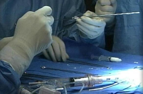 New movie looks at anesthesia awareness