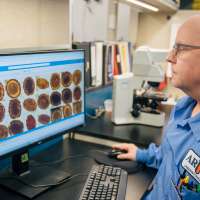 Utah study shows AI can quickly and accurately detect parasites in stool samples