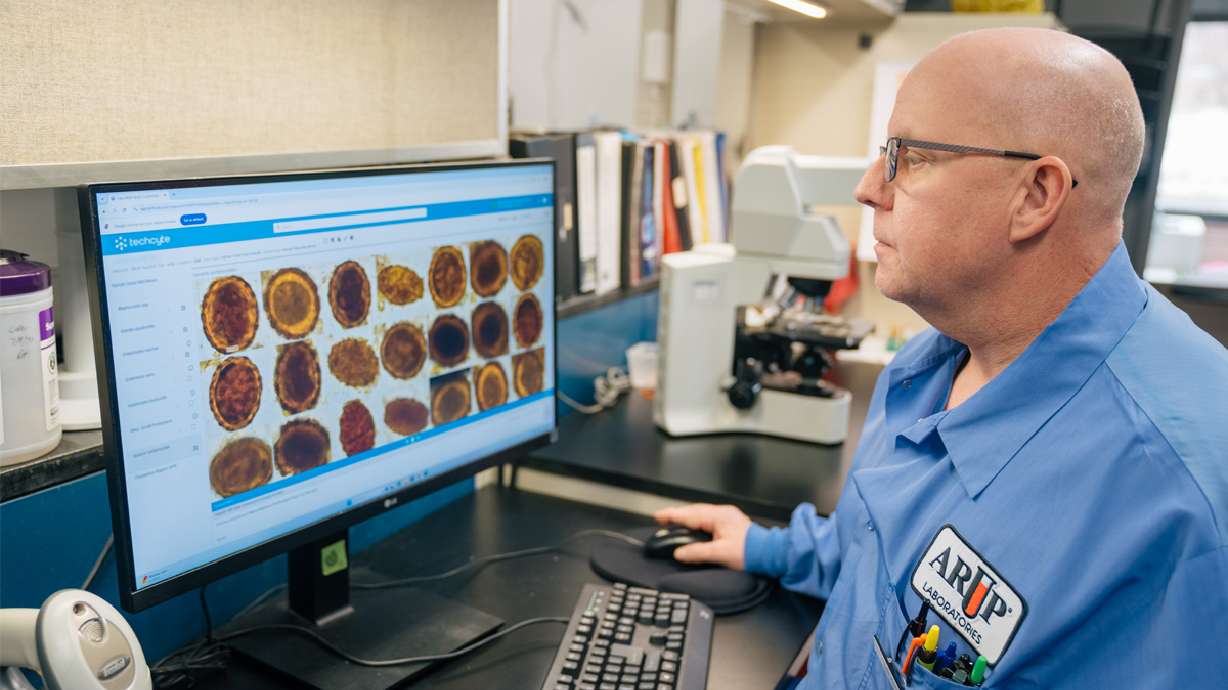 Utah study shows AI can quickly and accurately detect parasites in stool samples