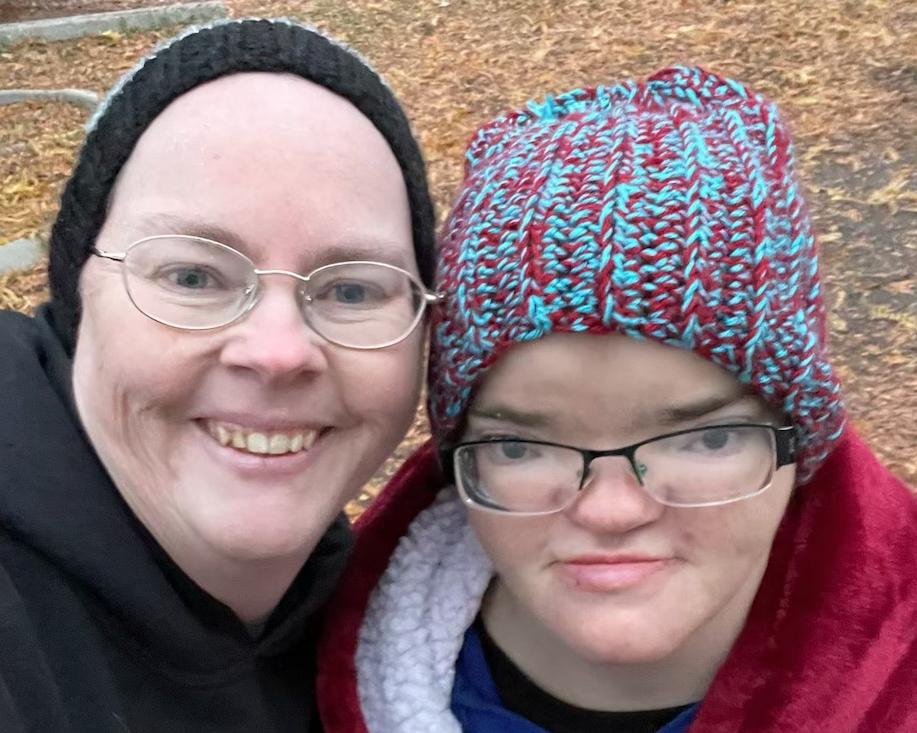 Woman born with 'twin inside of her' getting help from community fundraiser