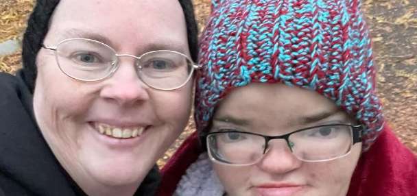 Woman born with 'twin inside of her' getting help from community fundraiser