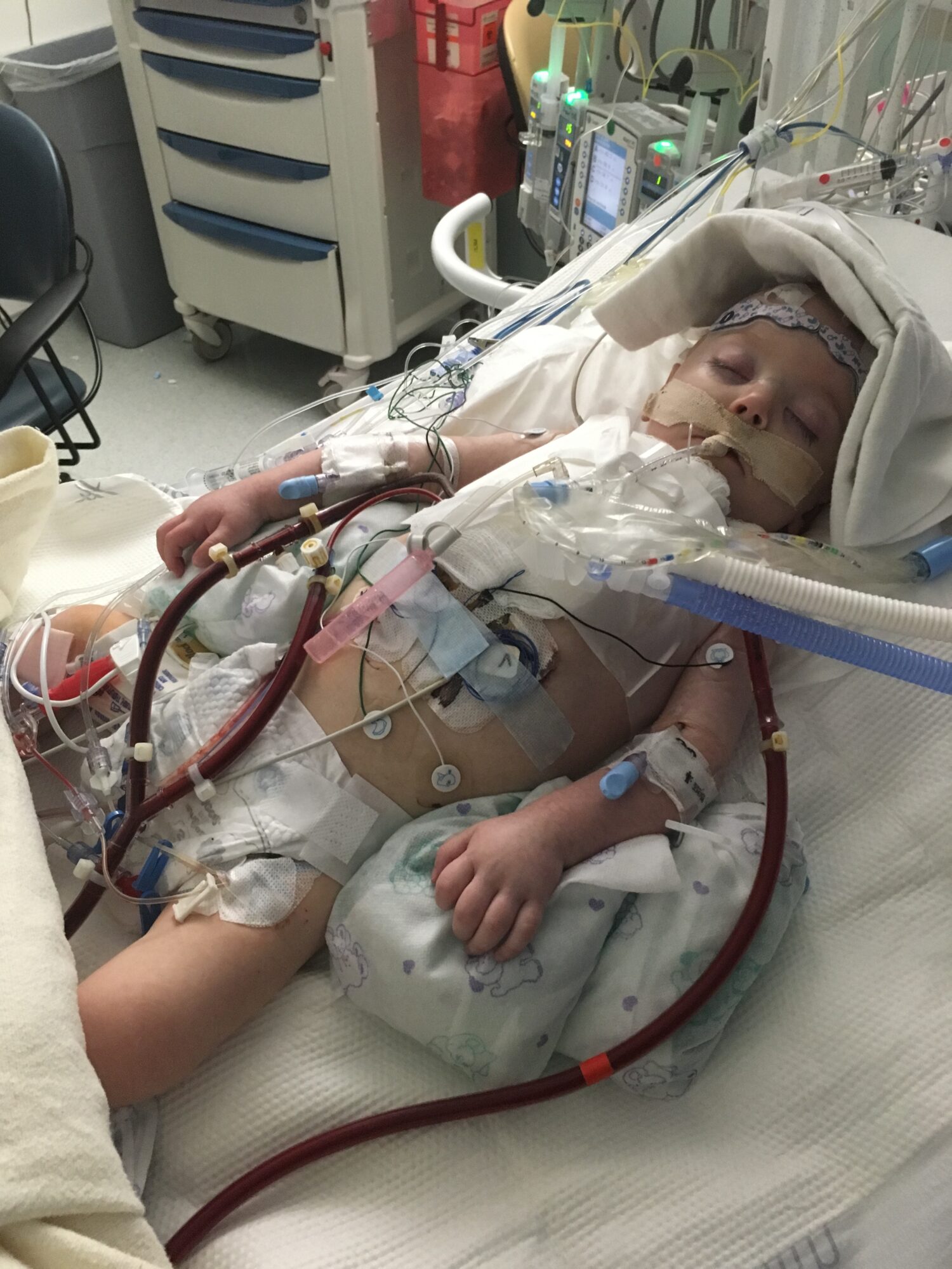 Ruth Kreitzer at Intermountain Primary Children's Hospital. Ruth was born with a rare congenital heart defect that left her in critical condition for weeks.