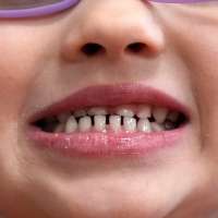 FDA moves to restrict fluoride supplements as part of MAHA agenda
