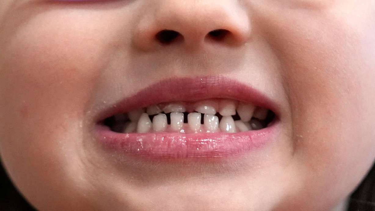 The FDA says fluoride supplements “should not be used in children under age 3 or by older children who are not at high risk of tooth decay.”