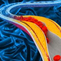 Pill may lower cholesterol in those who don't see benefit with statins alone