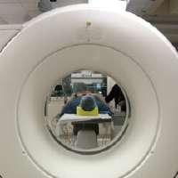 Huntsman Cancer Institute introduces first Angio-CT in the Mountain West