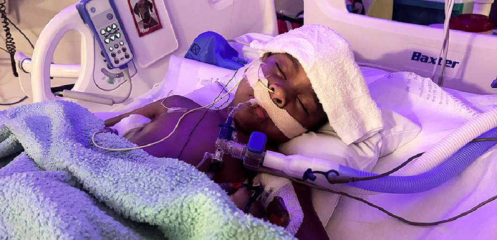 'Every moment is a fight': After surviving paralysis twice, Idaho 4-year-old faces another hurdle