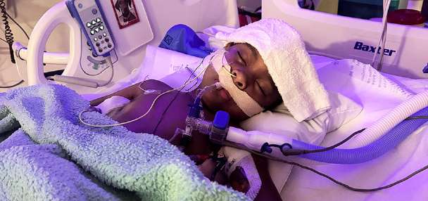 'Every moment is a fight': After surviving paralysis twice, Idaho 4-year-old faces another hurdle