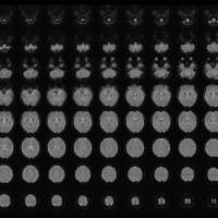 'Mind reading'? Scientist turns mental images into text using AI technology