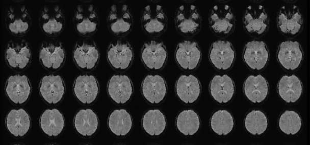 'Mind reading'? Scientist turns mental images into text using AI technology