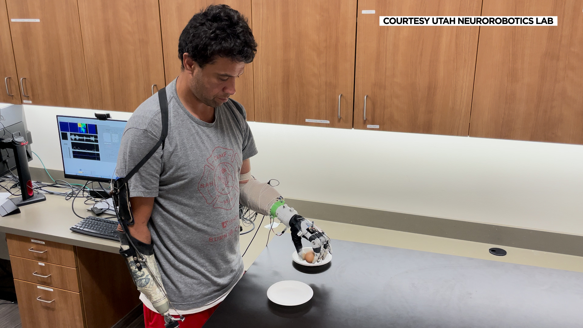 Sam Matagi holds an egg with a newly developed bionic hand. Matagi, who lost both arms in a work accident, was the first to use the hands, equipped with artificial intelligence.