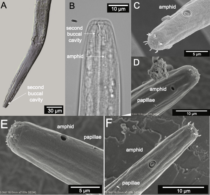Microscopic images of Diplolaimelloides woaabi, the newly identified nematode species from the Great Salt Lake. A study identifying the species for the first time was published last month.