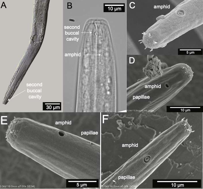 Microscopic images of Diplolaimelloides woaabi, the newly identified nematode species from the Great Salt Lake. A study identifying the species for the first time was published last month.
