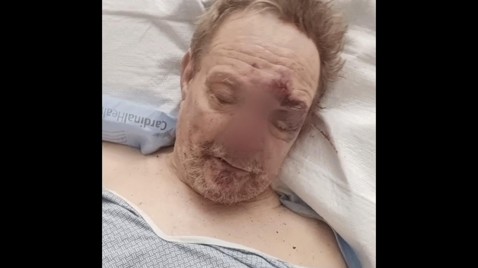 Man hospitalized after being run over, dragged by truck following robbery Friday