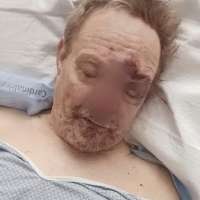 Man hospitalized after being run over, dragged by truck following robbery Friday