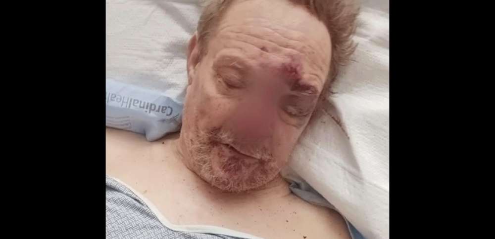 Man hospitalized after being run over, dragged by truck following robbery Friday