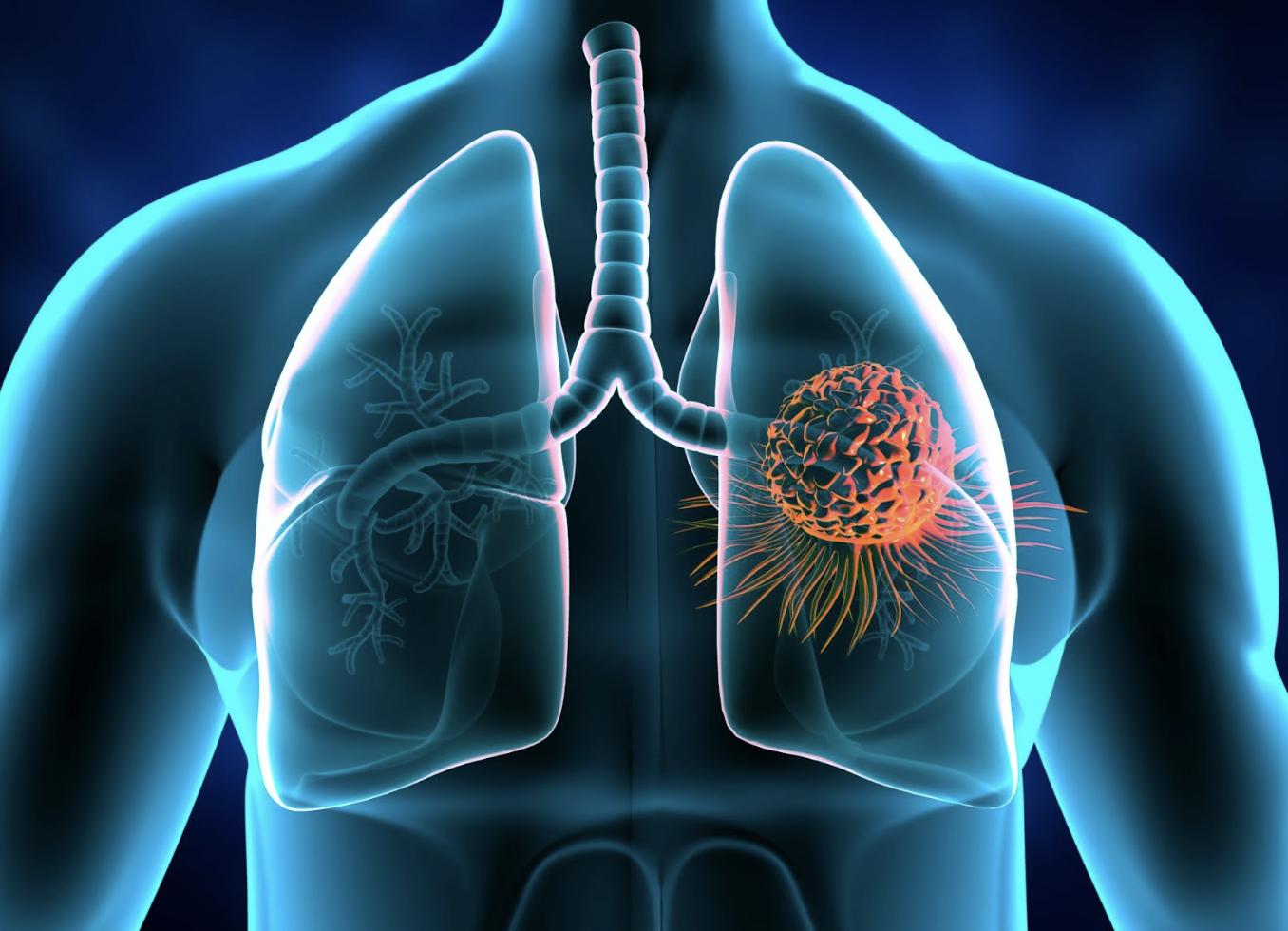 American Lung Association encourages Utah residents to test their homes for radon this month