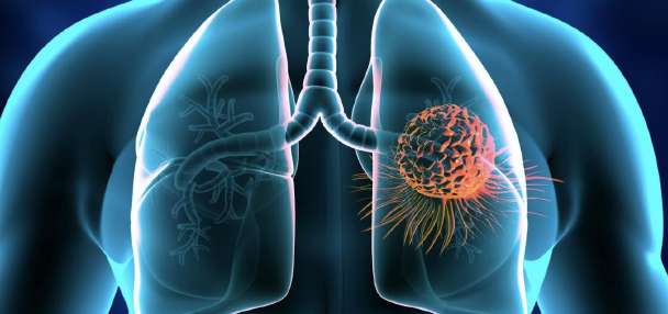 American Lung Association encourages Utah residents to test their homes for radon this month