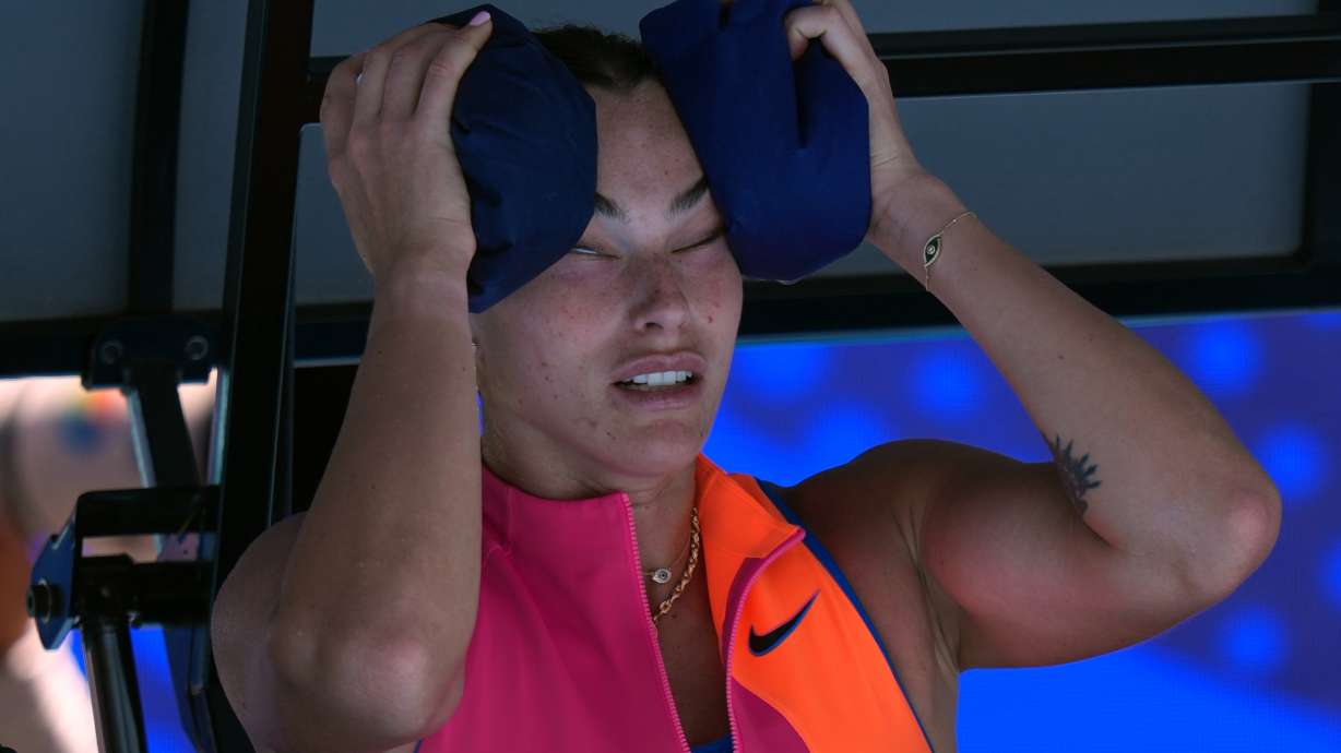Aryna Sabalenka of Belarus places ice packs to her face during her quarterfinal match against to Iva Jovic of the U.S. at the Australian Open tennis championship in Melbourne, Australia, Tuesday, Jan. 27, 2026.