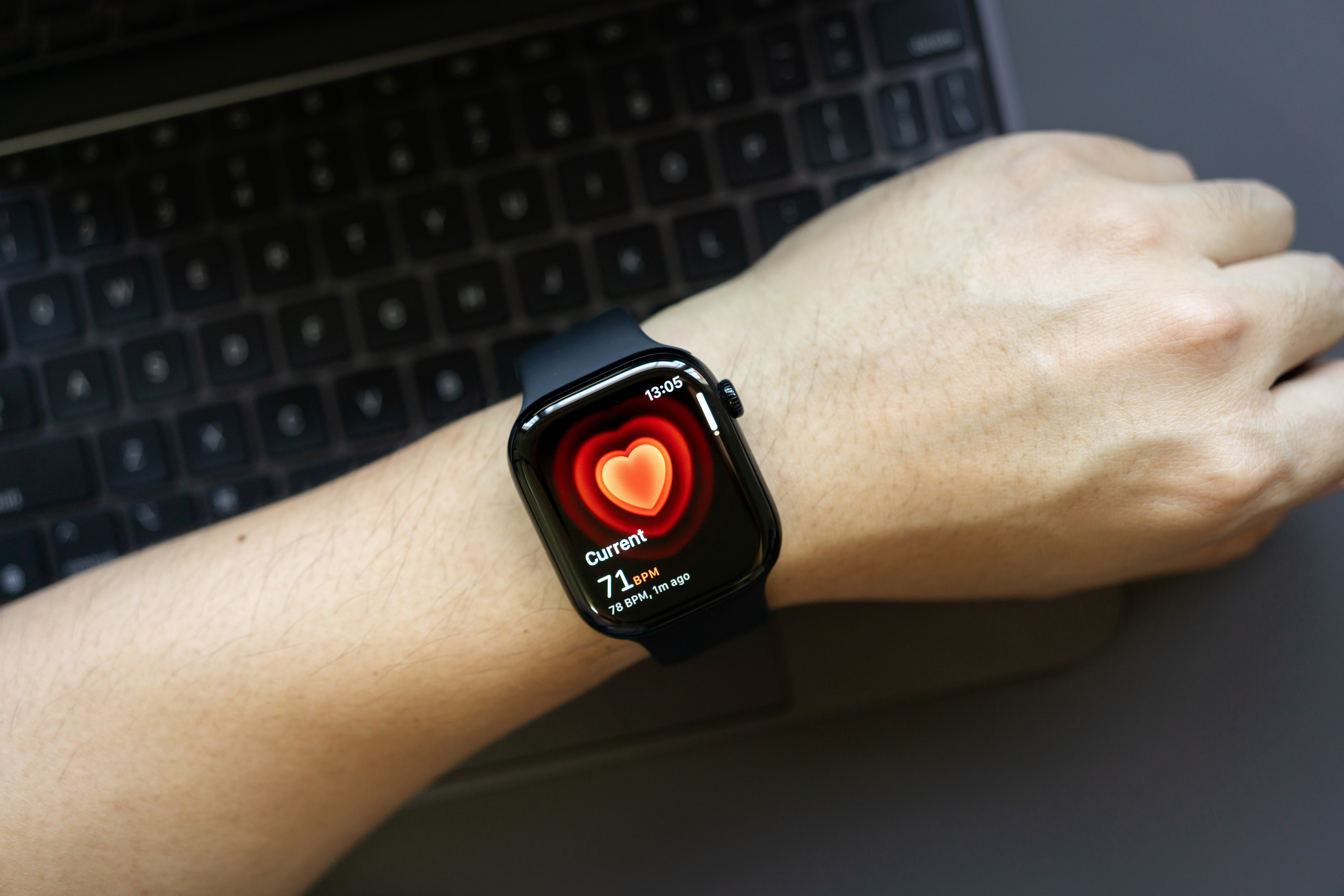 Smartwatch blood pressure feature should not replace screenings, U. Health study says