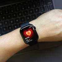 Smartwatch blood pressure feature should not replace screenings, U. Health study says
