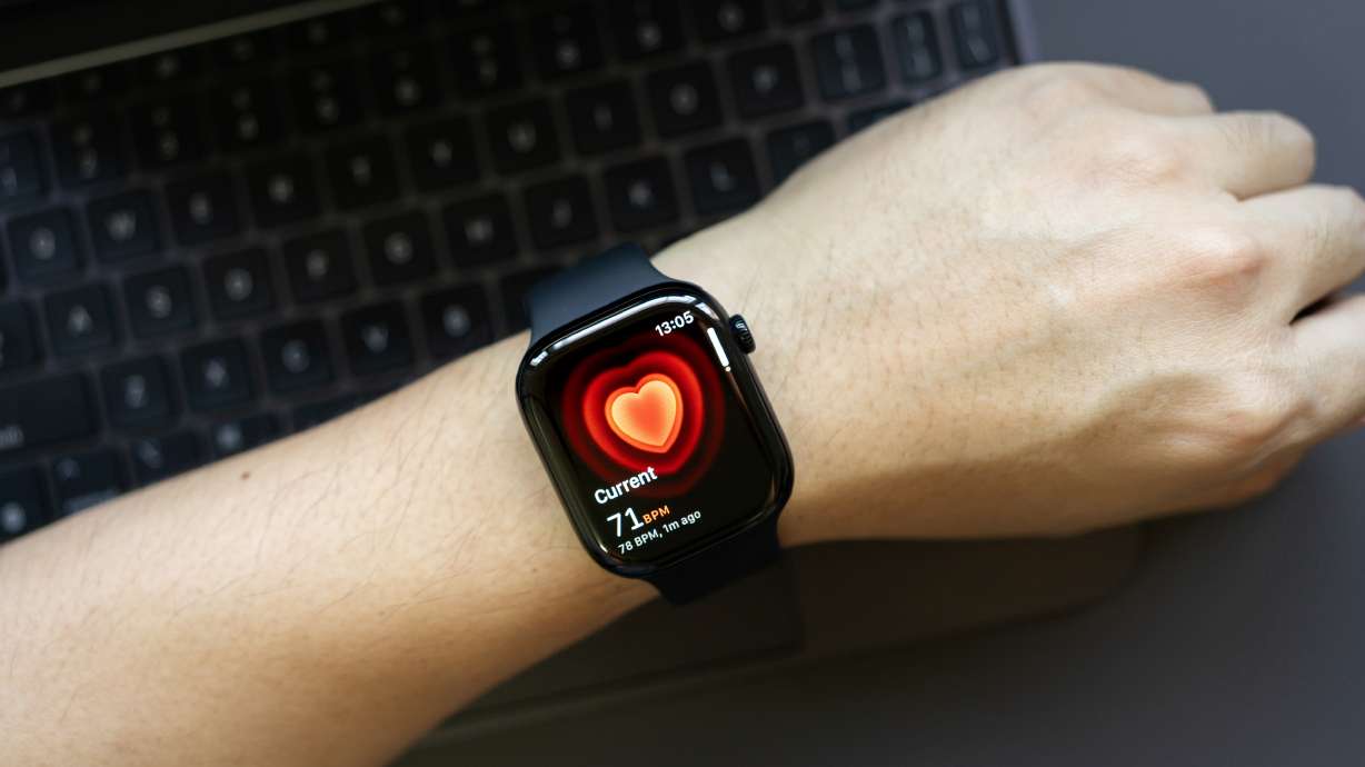 Researchers warned against using only an Apple Watch to screen for high blood pressure in a recent University of Utah Health study.