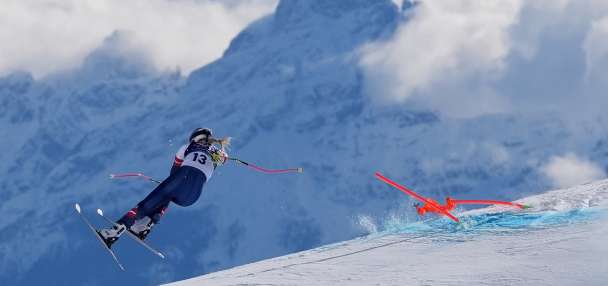 Lindsey Vonn says she had a 'successful' 3rd surgery on broken leg following crash at the Olympics