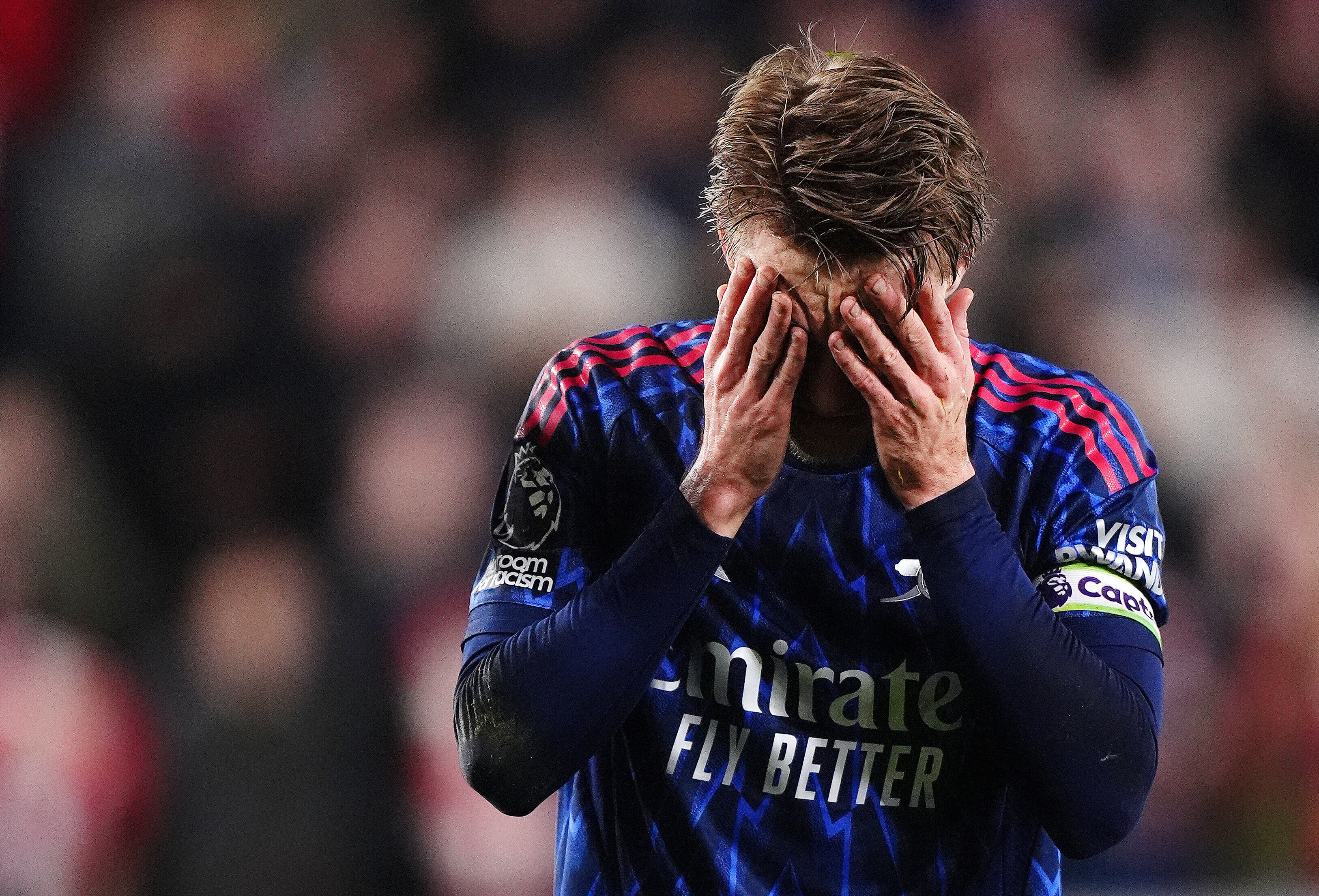 Arsenal's Martin Odegaard reacts after getting injured attempting to prevent Brentford's Keane Lewis-Potter from scoring during the English Premier League soccer match between Brentford and Arsenal in London, Thursday, Feb. 12, 2026. 