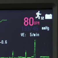 Irregular heartbeat? Experts say early care can prevent serious complications