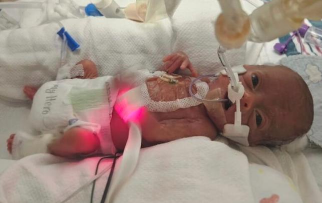Mom shares 22-week preemie's miraculous NICU journey through photos to inspire other parents