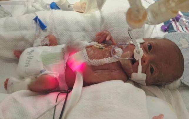 Mom shares 22-week preemie's miraculous NICU journey through photos to inspire other parents