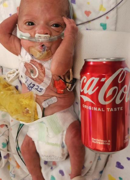 Mom shares 22-week preemie's miraculous NICU journey through photos to inspire other parents