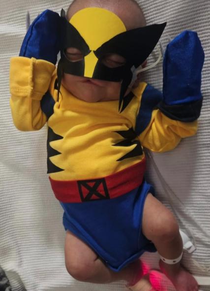 Mom shares 22-week preemie's miraculous NICU journey through photos to inspire other parents