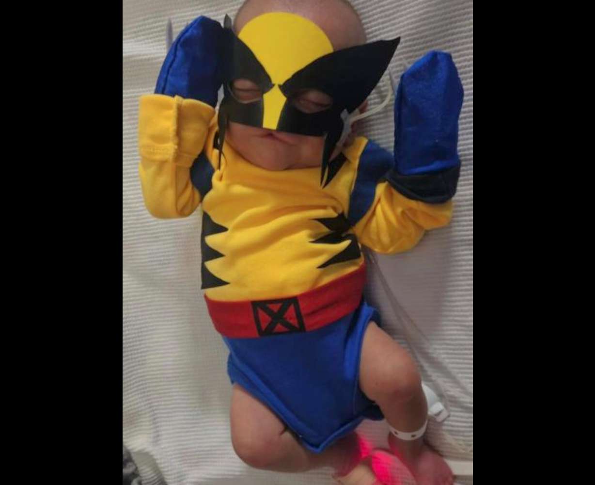 Mom shares 22-week preemie's miraculous NICU journey through photos to inspire other parents