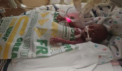 Mom shares 22-week preemie's miraculous NICU journey through photos to inspire other parents