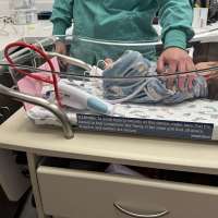 Utah's newborn screening test now covers Hunter syndrome, along with 44 other diseases