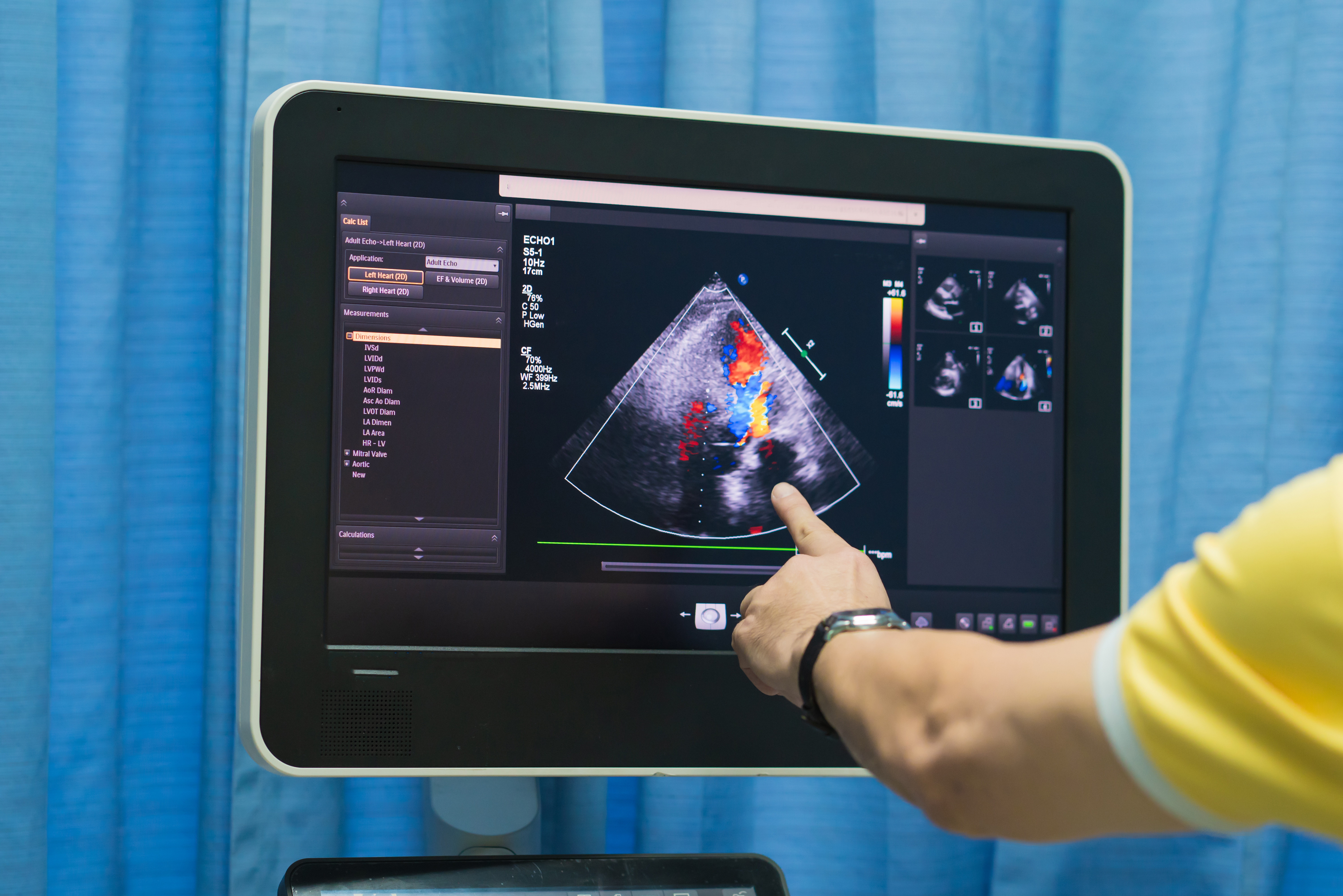 Stay ahead of health issues: Echo Ultrasound's $400 comprehensive body scan