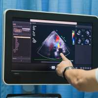 Stay ahead of health issues: Echo Ultrasound's $400 comprehensive body scan